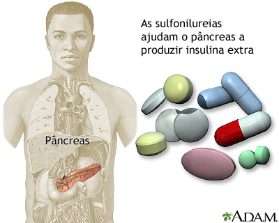 Composto de sulfonilureias