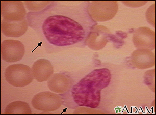 Mononucleose, fotomicrografia da célula