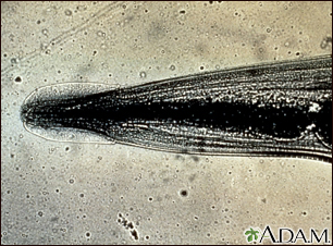 Nematoda, visão aproximada da cabeça