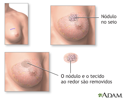 Procedimento