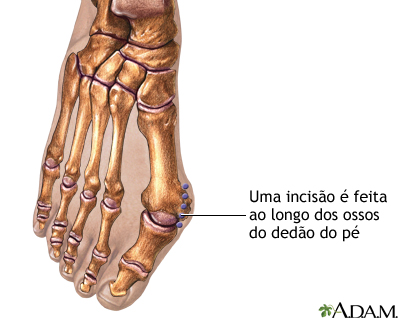 Procedimento, parte 1