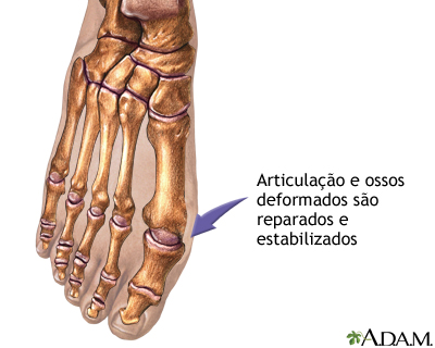 Procedimento, parte 2