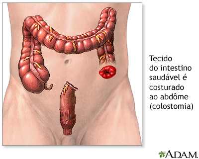 Procedimento, parte 2