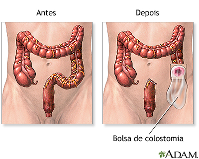 Cuidado após o procedimento