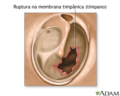 Indicação