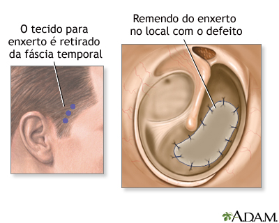 Procedimento