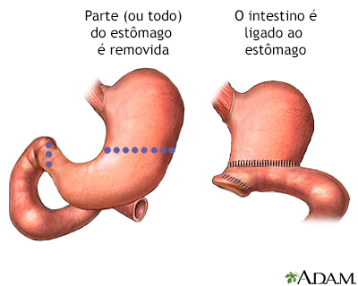 Procedimento