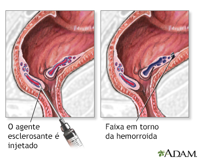 Procedimento