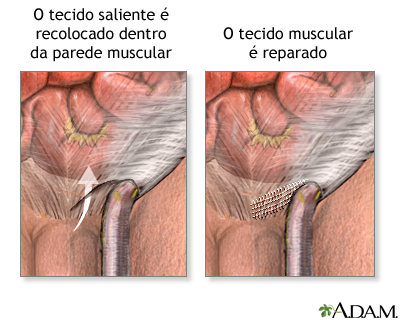 Procedimento