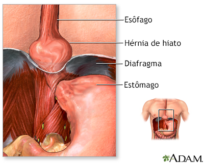 Indicações