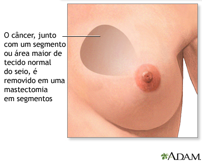 Procedimento 1