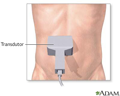 Ultrassom abdominal