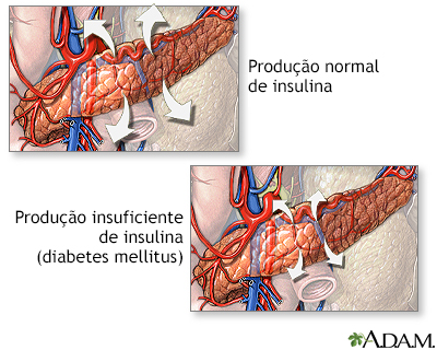 Produção de insulina e diabetes