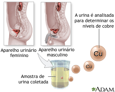 Teste de cobre na urina