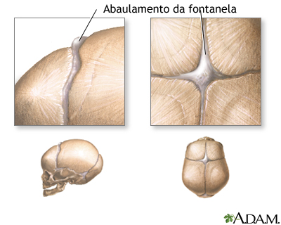 Fontanelas protuberantes