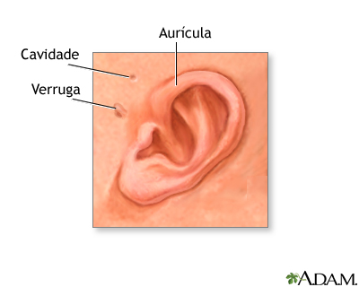 Anatomia auricular de recém-nascido