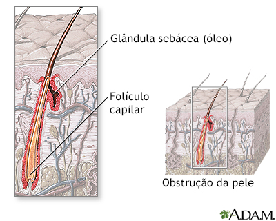 Anatomia de um folículo capilar