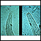 Hookworm - mouth of the organism