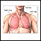 Pulmonary lobectomy - series - Normal anatomy