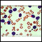 Leucemia de células pilosas - vista microscópica