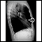 Lung nodule, right middle lobe - chest X-ray