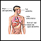 CMV (cytomegalovirus)