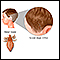 Head lice