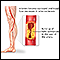 Arteriosclerosis of the extremities