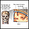 Meninges of the brain