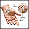 Compression of the median nerve