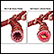 Normal versus asthmatic bronchiole