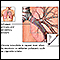 Causes of chronic bronchitis