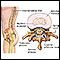 Disco intervertebral