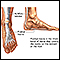 Fascia Plantar