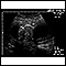 Ultrasound, normal fetus - abdomen measurements