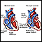 Tricuspid atresia