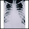 Pulmonía aguda por varicela - Rayos X de tórax