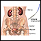 Biopsia ureteral