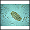 Ascaris lumbricoides egg