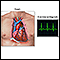 Electrocardiograma (ECG)