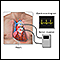 Holter heart monitor