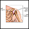 Inflamación de la articulación del hombro