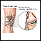 Ligamento colateral externo