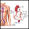 Arteriograma cardíaco