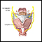 Laryngeal nerve damage