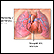 Hipertensión pulmonar primaria