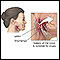 Oropharyngeal biopsy