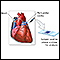 Cultivo de líquido pericardial